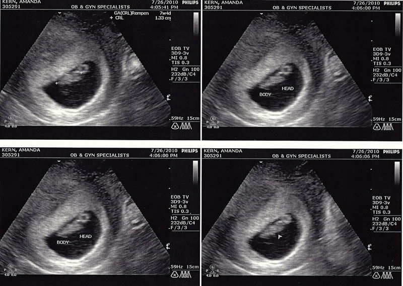 ultrasound-07262010