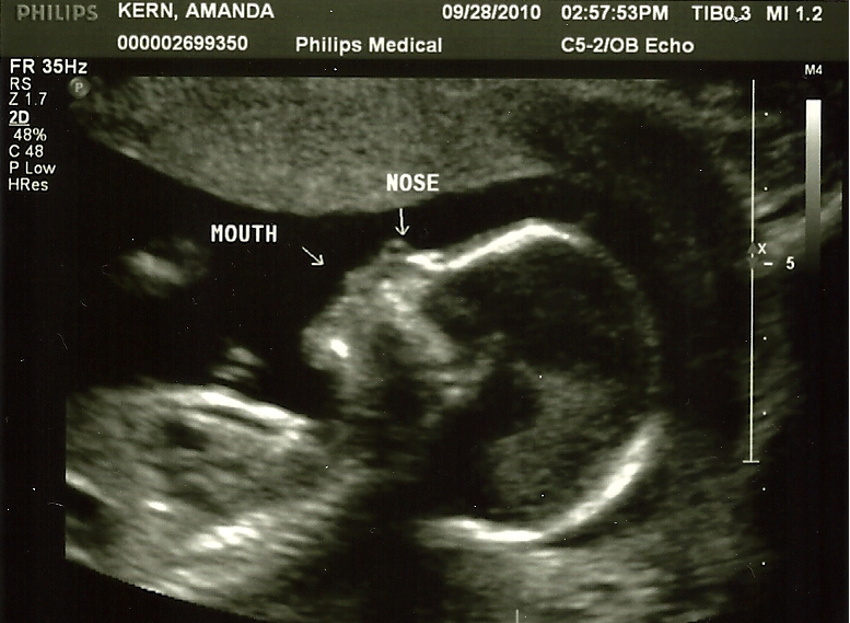 ultrasound-09282010