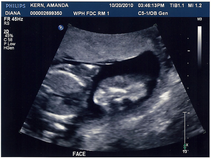 ultrasound-10202010