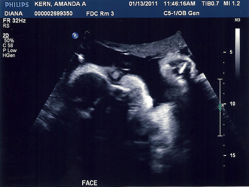 32 weeks pregnancy ultrasound vs 2 weeks old 🤍